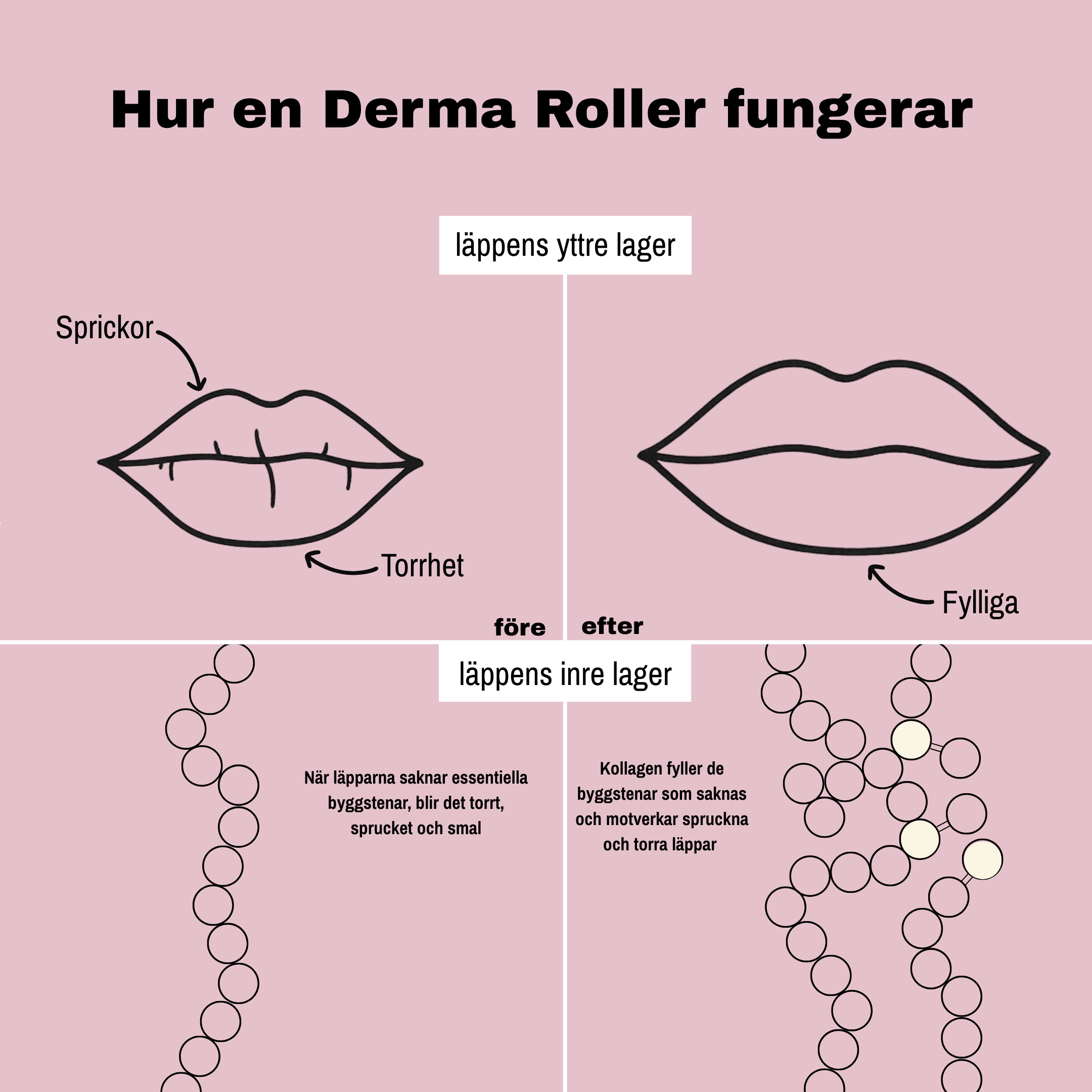 Derma Pen