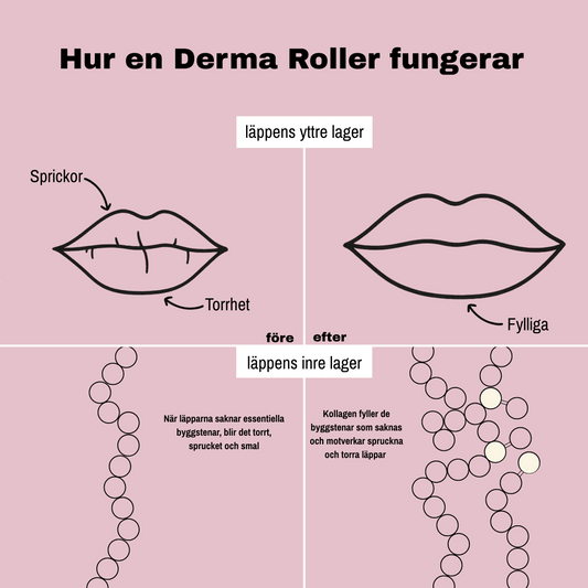 Derma Pen